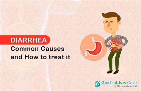 Diarrhea .